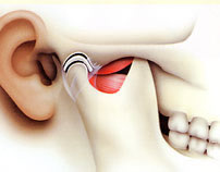 Esquema anatomico de articulacion temporomandibular